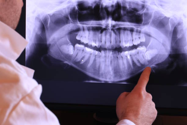 Best Dental Abscess Treatment in Drexel, OH