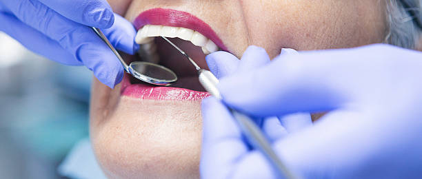 Best Emergency Care for Gum Disease in Drexel, OH
